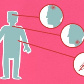 Schizophrenia Spectrum: Understanding the Diagnosis